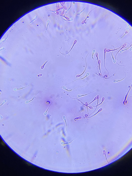 CLASSROOM COURSE ON SEMEN EVALUATION AND REPRODUCTIVE CAPACITY OF THE BULL.